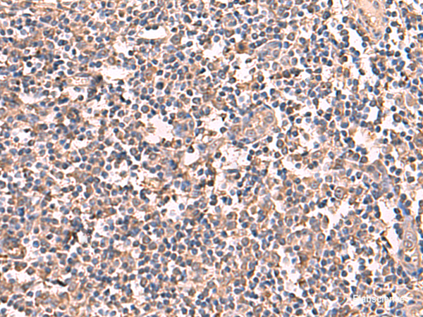 Anti-RIOK1