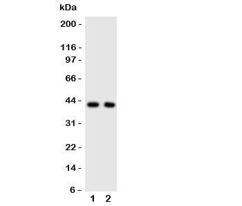 Anti-CXCR5