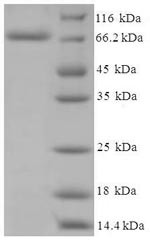 Cholesterol side-chain cleavage enzyme, mitochondrial (CYP11A1), human, recombinant