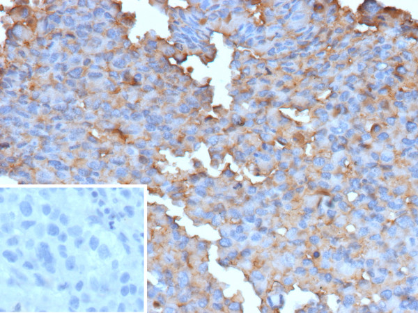 Anti-BRAF (V600E Mutant Specific) (Prognostic Marker), recombinant antibody, clone BRAF-V600E/13276R