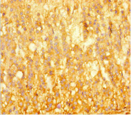 Anti-BRD3