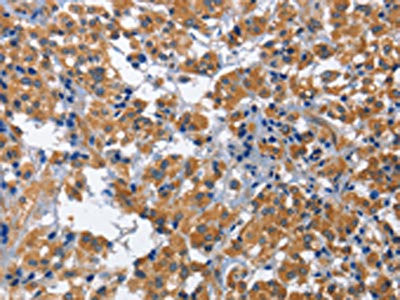Anti-CDK5RAP3