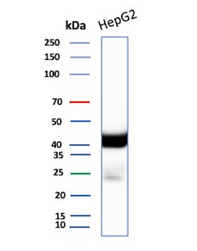 Anti-CD7 (T-Cell Leukemia Marker), clone B-F12