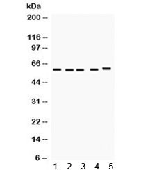 Anti-FMO1