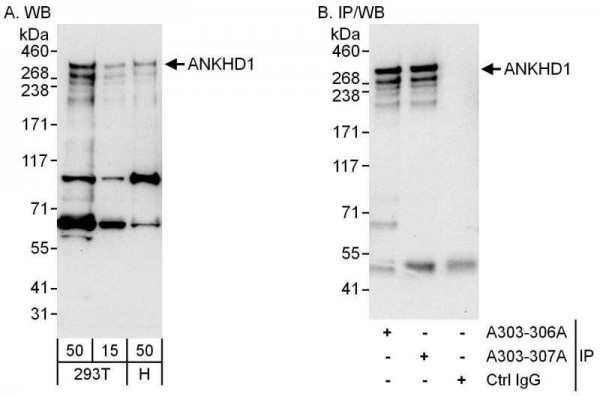 Anti-ANKHD1
