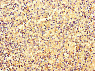 Anti-EBF2