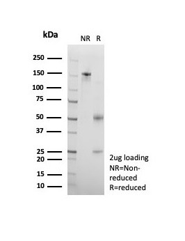 Anti-CD95 / FAS / TNFRSF6, recombinant antibody, clone rB-R18