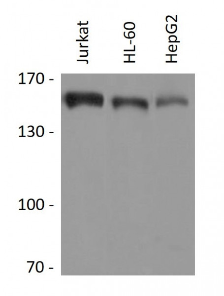 Anti-IARS / Isoleucyl tRNA synthetase