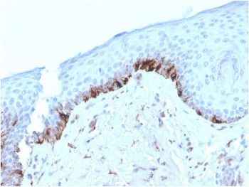 Anti-TRP1 / Tyrosinase-Related Protein-1, clone TYRP1/3282