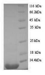 Shiga-like toxin 2 subunit B (stxB2), Enterobacteria phage 933W, recombinant