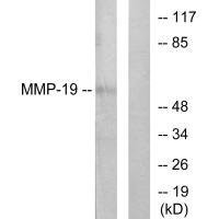 Anti-MMP19
