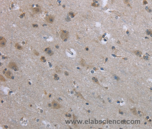 Anti-EGFL8