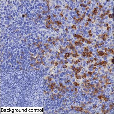 Anti-PDCD1