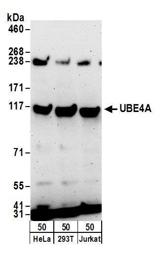Anti-UBE4A