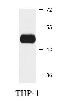 Anti-PSTPIP1