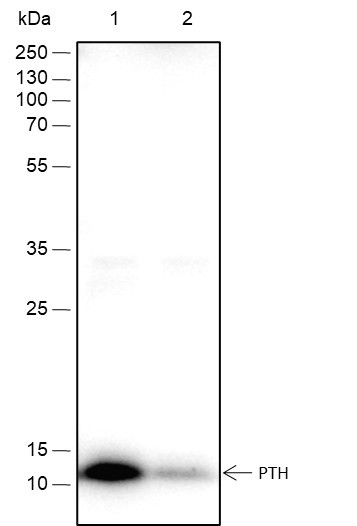 Anti-Recombinant PTH, clone A345