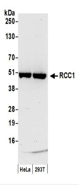 Anti-RCC1