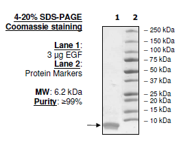 Epidermal Growth Factor (EGF), active human recombinant protein (rHuEGF)