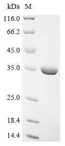 Lys-63-specific deubiquitinase BRCC36 (Brcc3), mouse, recombinant