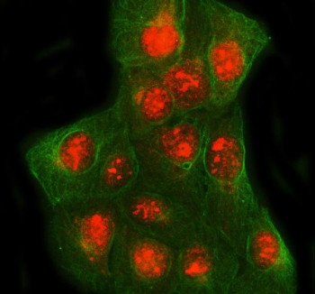 Anti-SPIDR / Scaffold protein involved in DNA repair