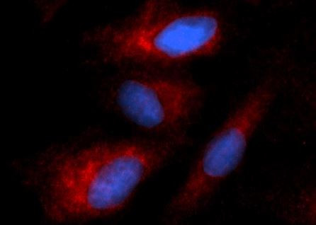 Anti-Cytokeratin 8 (RPE)