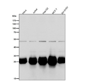 Anti-BCL2L1 / Bcl-X, clone 31B78
