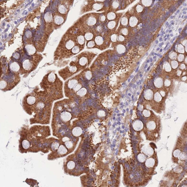 Anti-SULT1A1