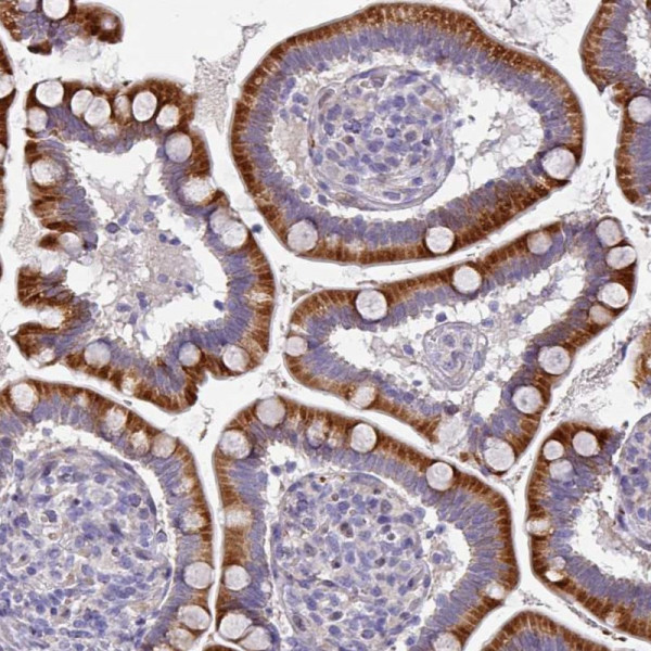 Anti-KLHL3