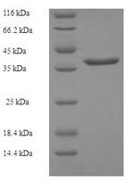 Cysteine-rich protein 2 (CRIP2), human, recombinant