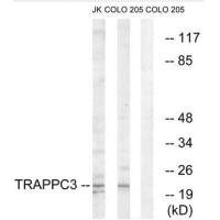 Anti-TRAPPC3