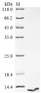 Endothelin-3 (EDN3), human, recombinant