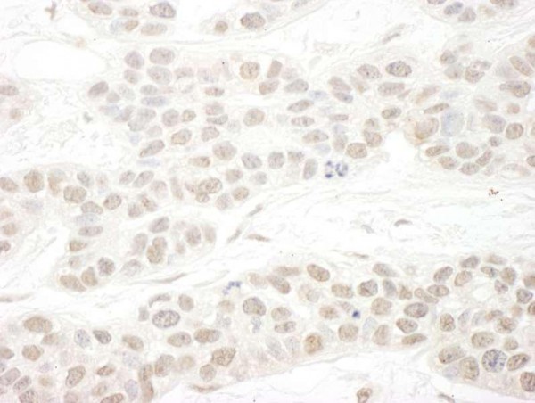 Anti-hSET1B (IHC)