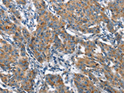 Anti-CHMP1A