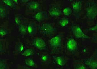 Anti-alpha Actinin-3