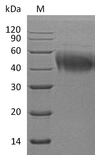 Interleukin-4 receptor subunit alpha (IL4R), partial (Active), human, recombinant