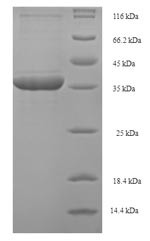 Phospholysine phosphohistidine inorganic pyrophosphate phosphatase (LHPP), human, recombinant