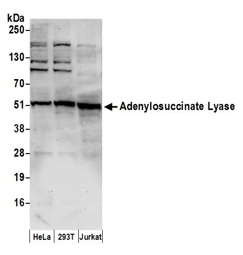 Anti-Adenylosuccinate Lyase/ADSL
