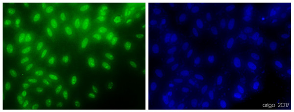 Anti-SIRT6, clone 6C9-D10-D3