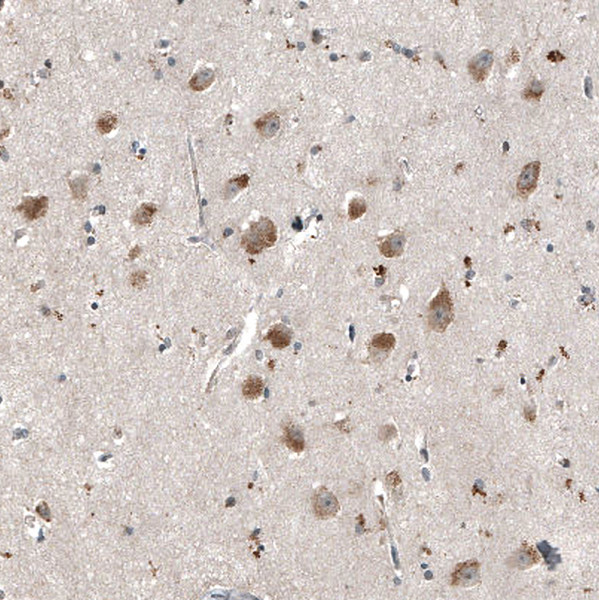 Anti-MYO10, clone CL9032