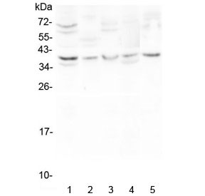 Anti-CD24