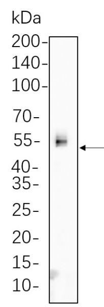 Anti-Recombinant Phospho-Chk1 (Ser345), clone 9C1