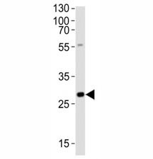 Anti-Olig3
