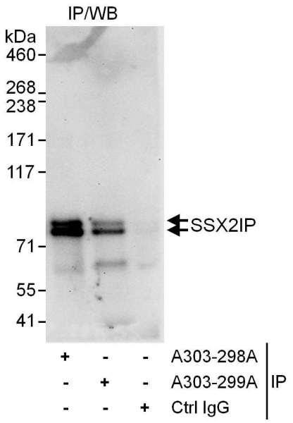 Anti-SSX2IP