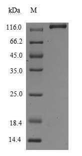 Leukemia inhibitory factor receptor (LIFR), partial (Active), human, recombinant