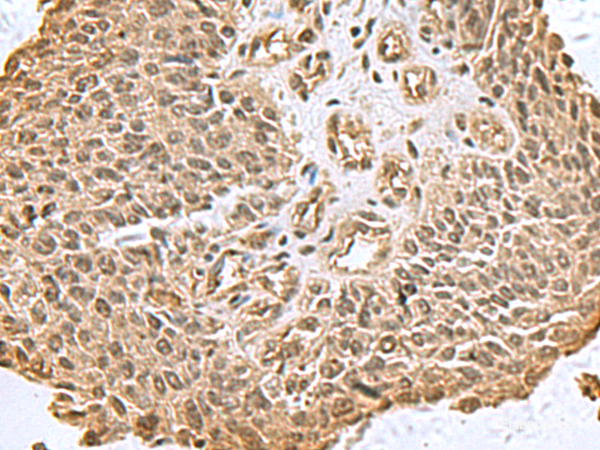 Anti-DCTPP1