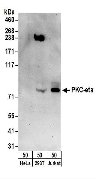 Anti-PKC-eta