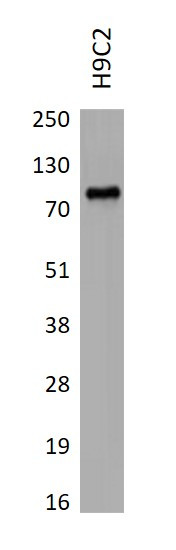 Anti-SGLT2