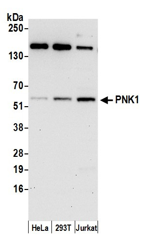 Anti-PNK1