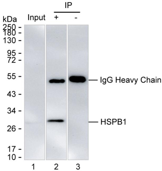 Anti-HSPB1