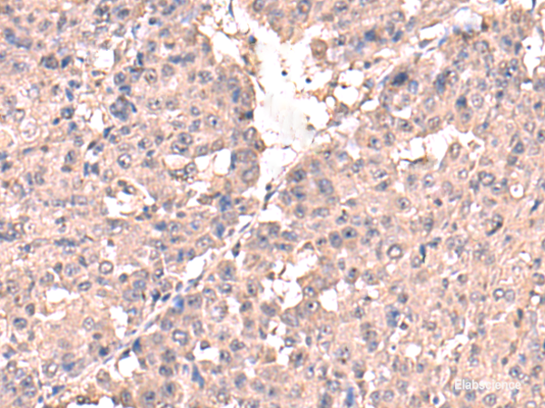 Anti-HPN